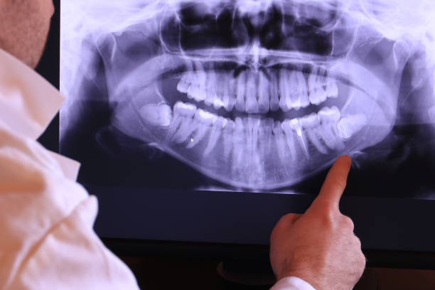Best Broken or Cracked Tooth Emergency Dentist in Dahlone, GA
