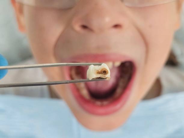 Best Weekend Emergency Dentist in Dahlone, GA